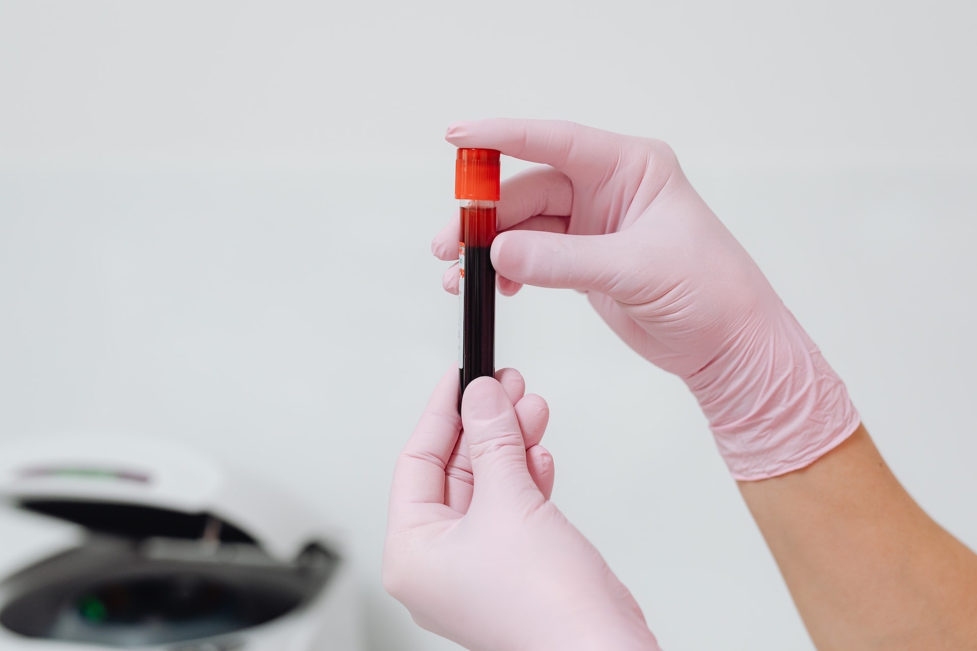 What You Need To Know About Getting A Blood Count Test Premium Healthcare