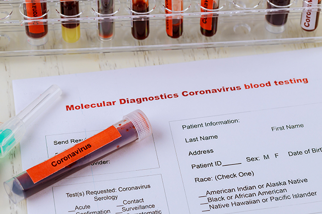 Complete blood count test tubes 2019-nCoV from China the virus causes atypical pneumonia 2019-nCoV from China the virus causes atypical pneumonia complete blood count test tubes