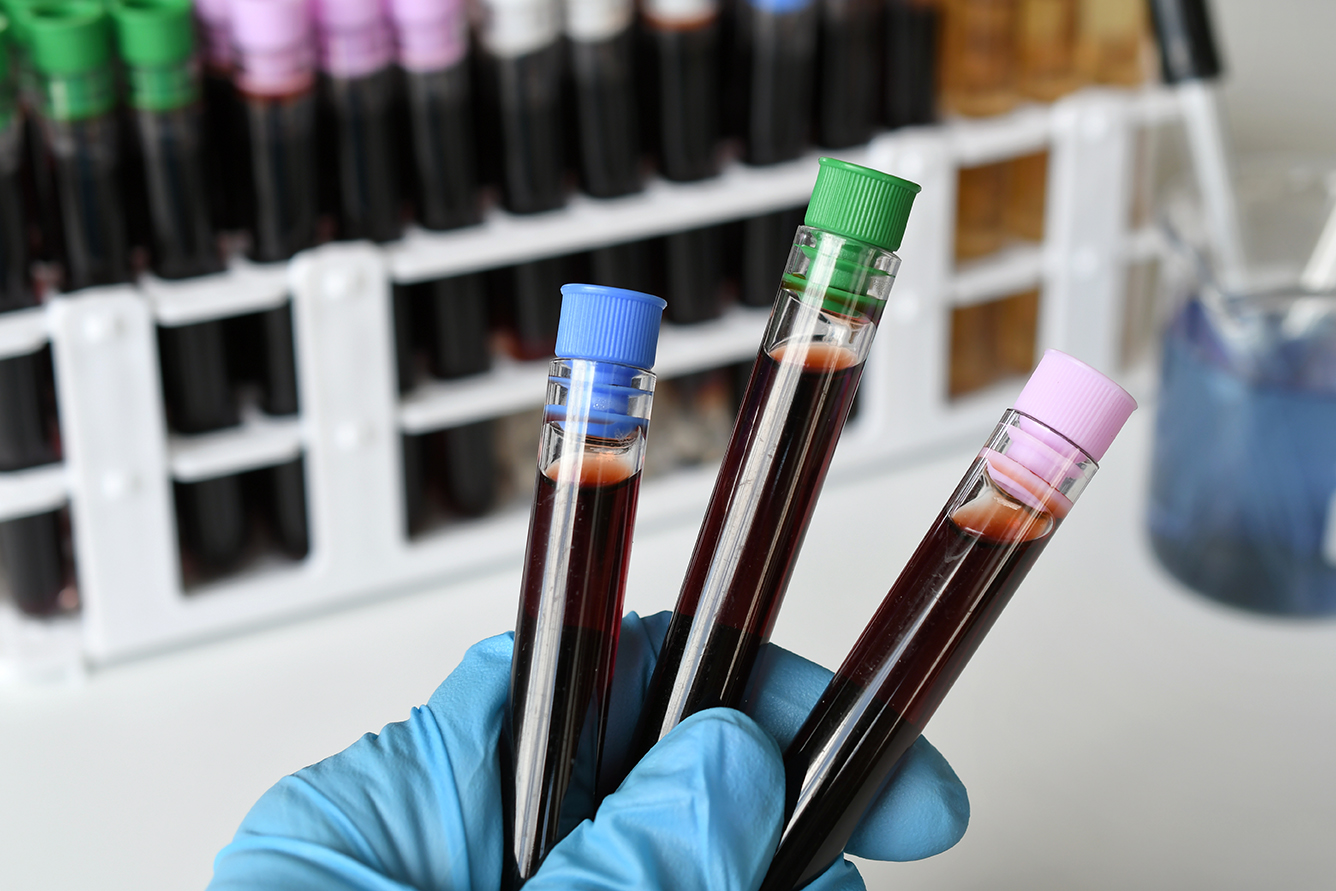 a-medical-worker-lab-technician-holding-vials-of-b-2023-11-27-05-06-03-utc a-medical-worker-lab-technician-holding-vials-of-b-2023-11-27-05-06-03-utc