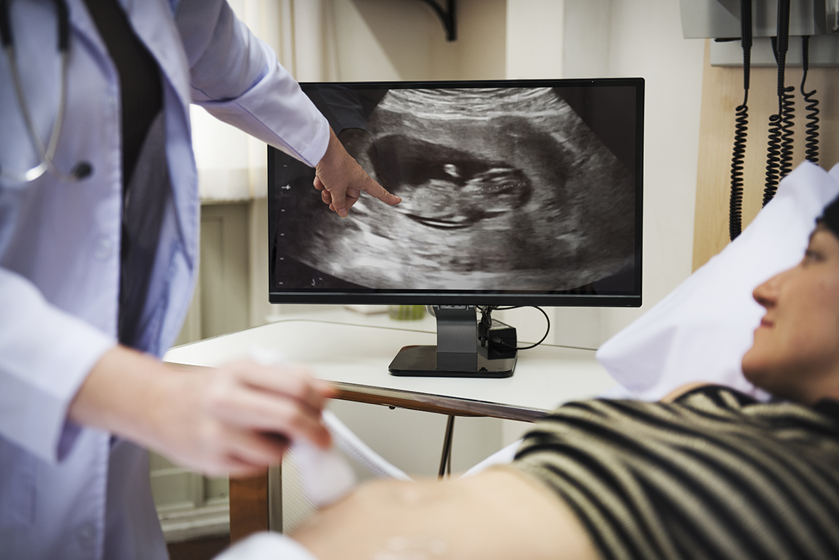 A trimester pregnant woman A trimester pregnant woman