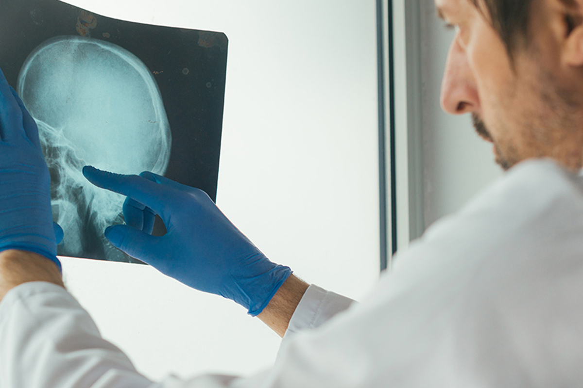 Prevention is better than cure. Shot of a young doctor examining Prevention is better than cure. Shot of a young doctor examining an x-ray in an office