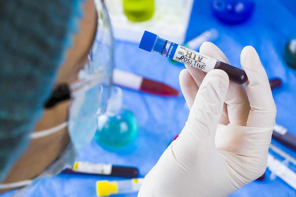 Doctor holding HIV and aids infection test tubes with blood on a blue background A doctor holding HIV and aids infection test tubes with blood on a blue background