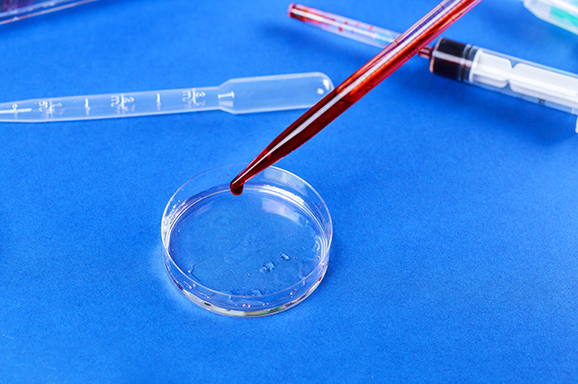 Exam test analysis hospital with pipette and petri dish Exam test with pipette and petri dish blood infected virus in medical laboratory blood analysis hospital
