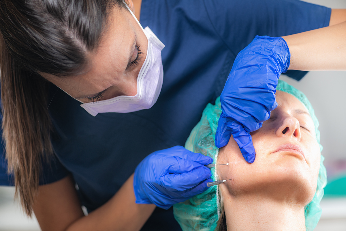 Meso Threads Face Lifting Treatment. Mesotherapy in Aesthetic Medicine Face lifting Mesotherapy Treatment with Meso Threads