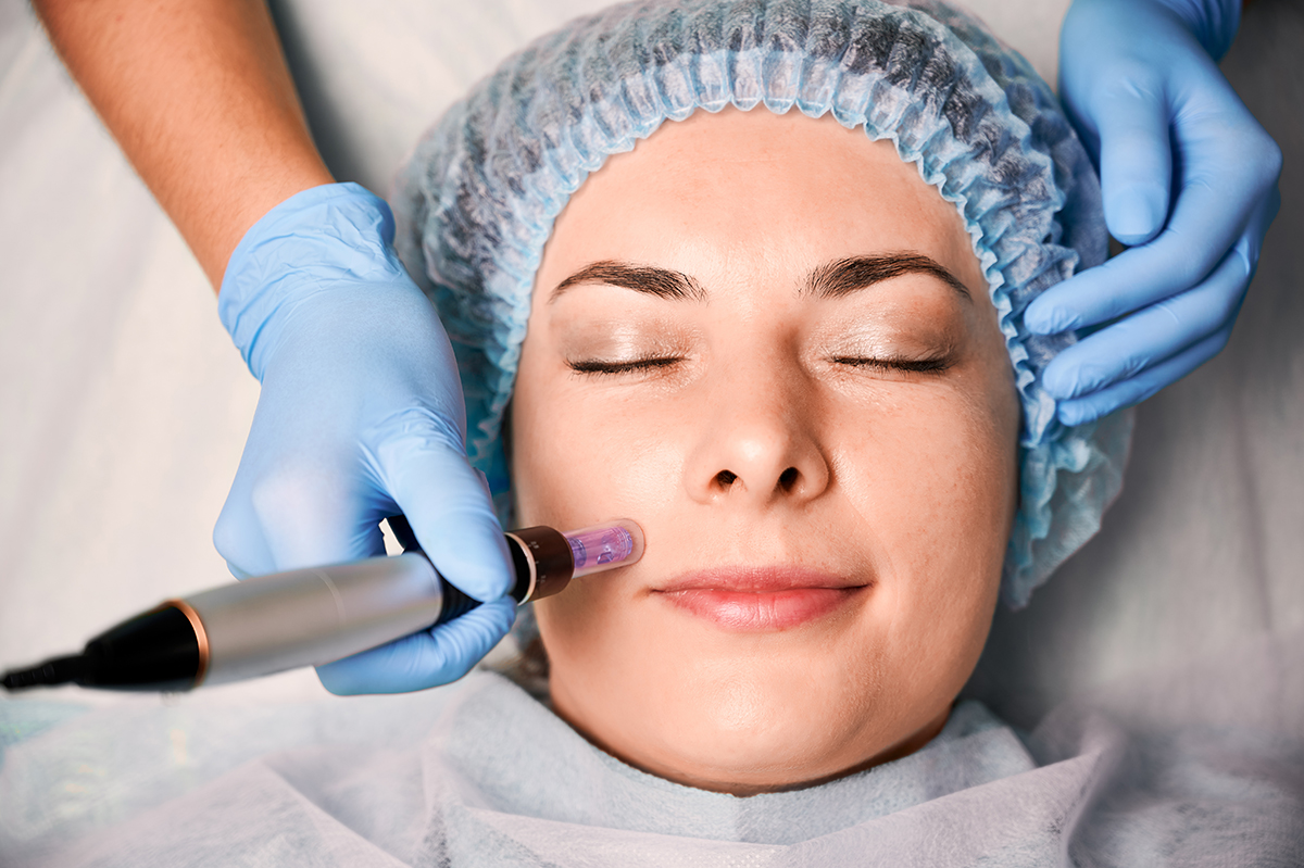 Young woman having fractional mesotherapy at wellness center. Close up of beautician hands in sterile gloves using dermapen during skincare procedure. Young woman receiving facial treatment in beauty salon. Concept of skincare and collagen induction therapy.