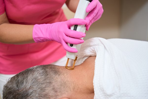 Laser hair removal on the back of the head of a man in a medical clinic. Cropped