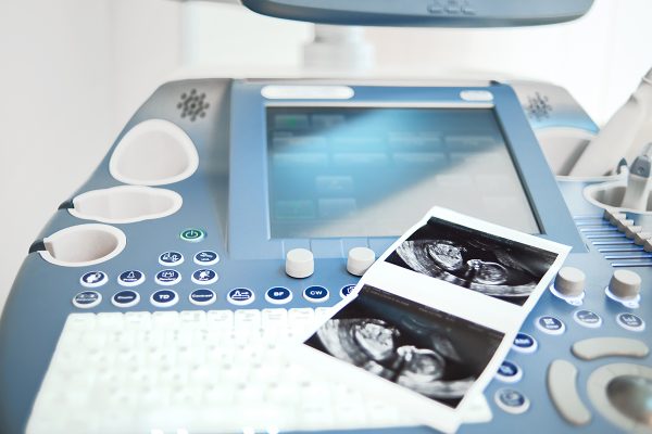 Ultrasound scanning machine with sonogram picture on keyboard copyspace pregnancy diagnostic healthcare medical industry scanner device machine concept.